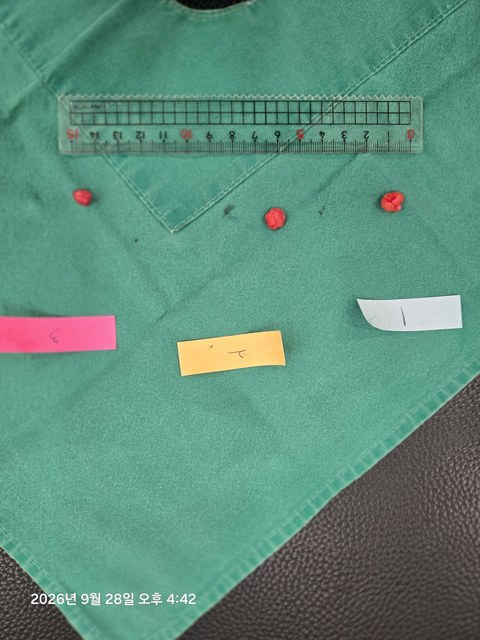 팔 피하 지방종 제거 증례의 제거 조직 사진