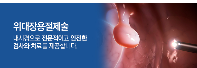 12년 이상 경험을 지닌 최고의 전문의! 내시경으로 거마부터 조기암 수술까지! 전문적이고 안전한 검사와 치료를 제공합니다.